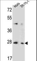 TM4SF4 Antibody (aa16-45)