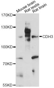 Polyclonal Rabbit anti-Human CDH3 / P-Cadherin Antibody (IHC, WB)