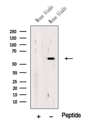 Polyclonal Rabbit anti-Human OSGIN1 Antibody (WB)