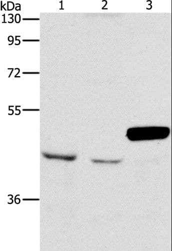 Polyclonal Rabbit anti-Human ARMCX3 Antibody (IHC, WB)