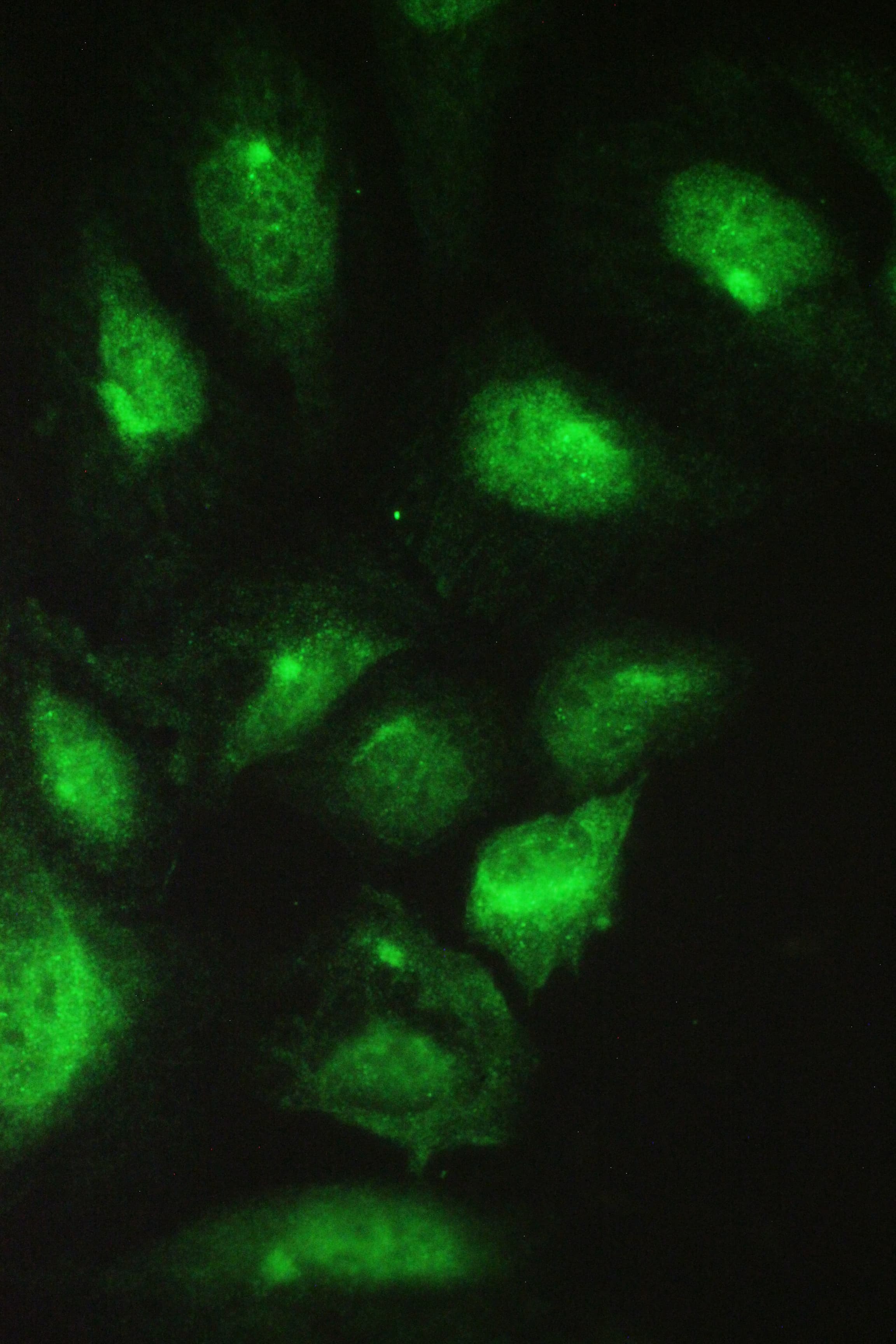CCT2 / CCT Beta Antibody