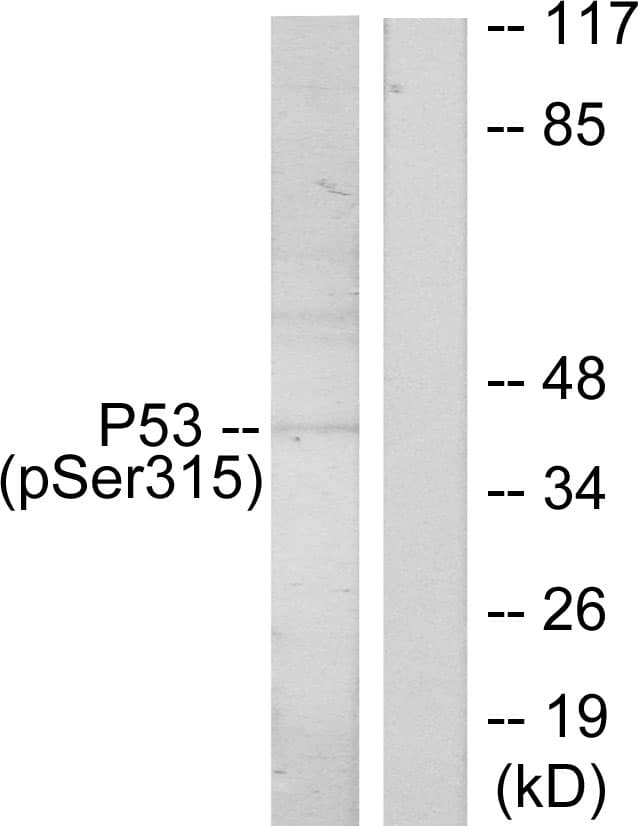 Polyclonal Rabbit anti-Human TP53 / p53 Antibody (phospho-Ser315, IHC, WB)