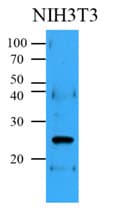 BCL2 / Bcl-2 Antibody (clone AT1B5)