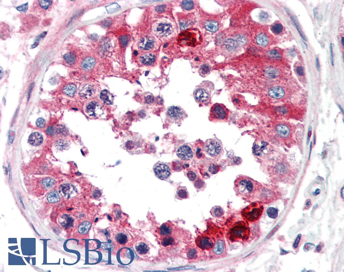 IHC-plus™ CLU / Clusterin Antibody