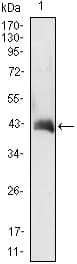 CSF2 / GM-CSF Antibody (clone 3D3)