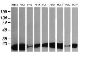 LZIC Antibody (clone OTI5E3)