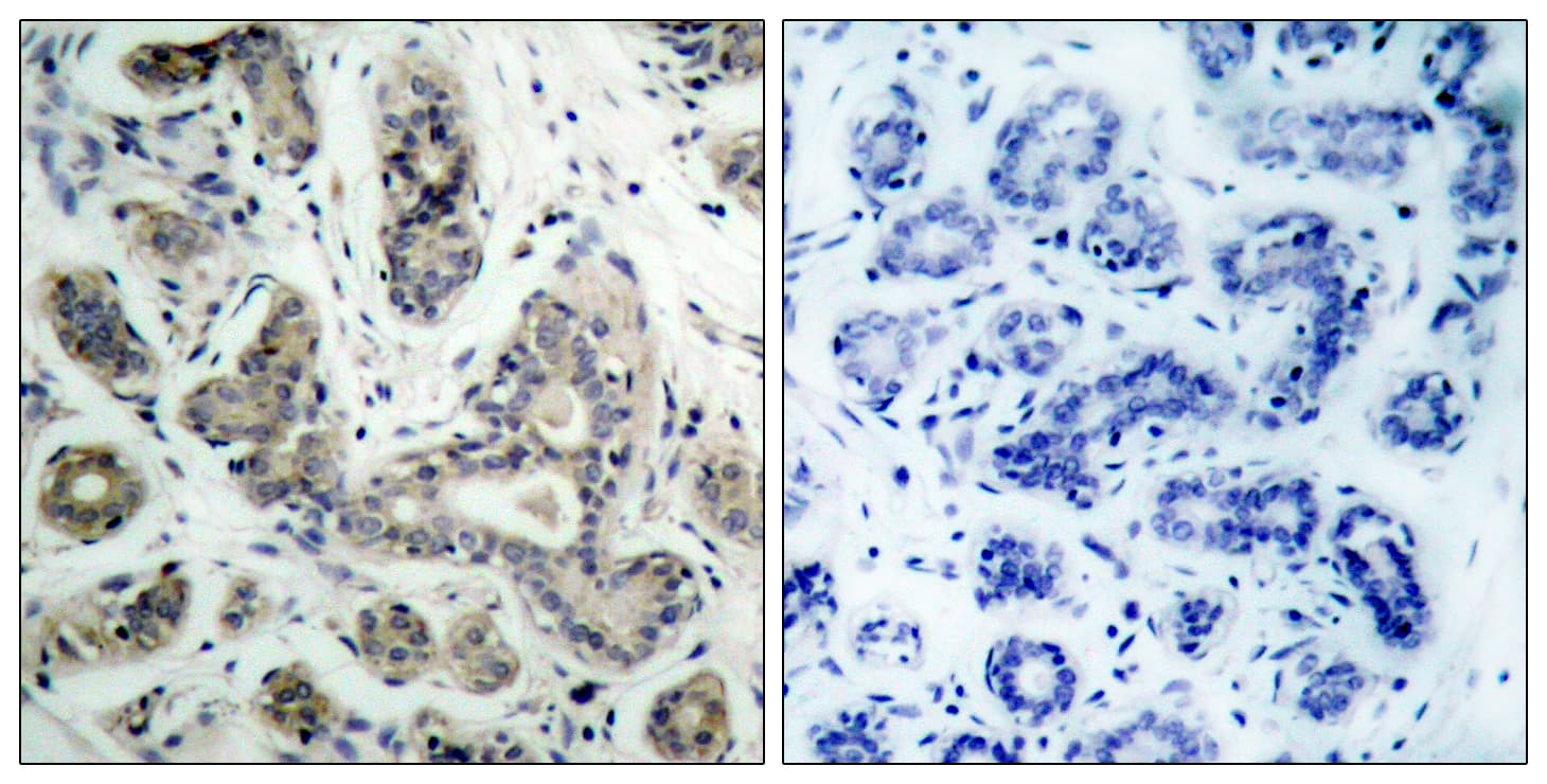 Polyclonal Rabbit anti-Human PDPK1 / PDK1 Antibody (aa210-259, IHC, WB)