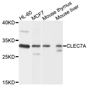 Polyclonal Rabbit anti-Human CLEC7A / Dectin 1 Antibody (WB)