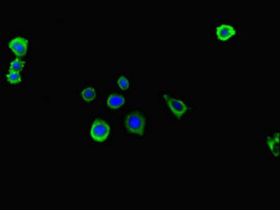 ITGA4 / VLA-4 / CD49d Antibody