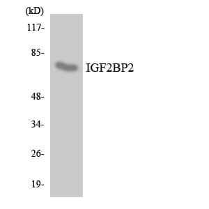 Polyclonal Rabbit anti-Human IGF2BP2 Antibody (aa130-179, WB)