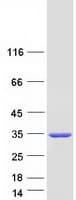 Human SULT1A1 / Sulfotransferase 1A1 Protein (Recombinant Myc-DDK (Flag))