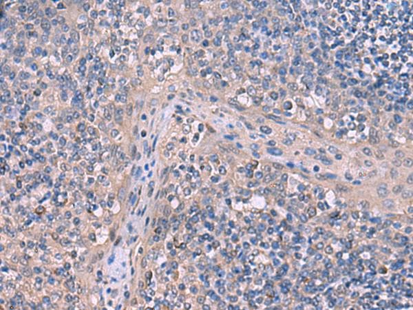 ITPR2 / IP3 Receptor Type 2 Antibody