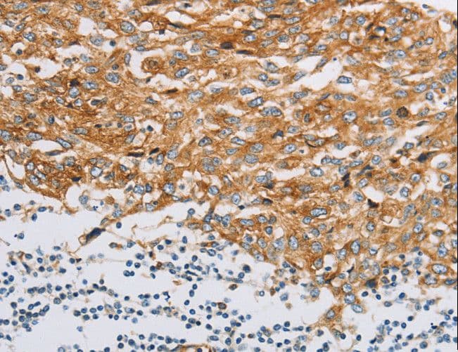 Fragilis / IFITM3 Antibody