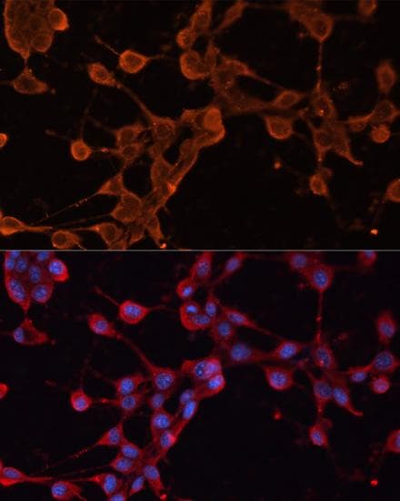 ABCB11 / BSEP Antibody