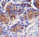 Polyclonal Rabbit anti-Human CASP12 / Caspase 12 Antibody (aa165-193, IHC, IF, WB)