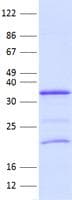 Human LIN28B Protein (Recombinant His, N-Terminal)