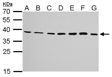 IHC-plus™ Polyclonal Rabbit anti-Human JAM2 Antibody (aa1-294, IHC, WB)