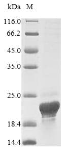 Human ASPRV1 / SASPase Protein (Recombinant 10His, N-terminus + Myc, C-terminus)