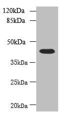 Polyclonal Rabbit anti-Human NSUN4 Antibody (IHC, WB)