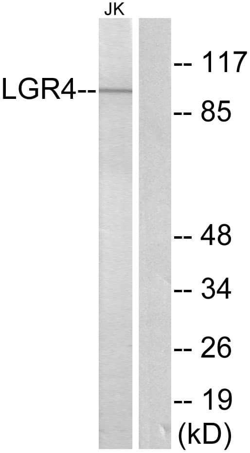 GPR48 / LGR4 Antibody (aa461-510)