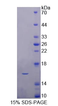Pig FABP1 / L-FABP Protein (Recombinant His-T7)