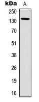 Polyclonal Rabbit anti-Human GRM1 / MGLUR1 Antibody (Internal, WB)