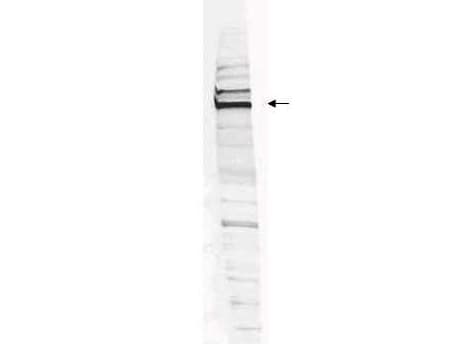 IHC-plus™ Polyclonal Rabbit anti-Human WRNIP1 / WHIP Antibody (IHC, WB)