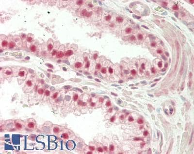 IHC-plus™ RNF20 Antibody (aa125-175)
