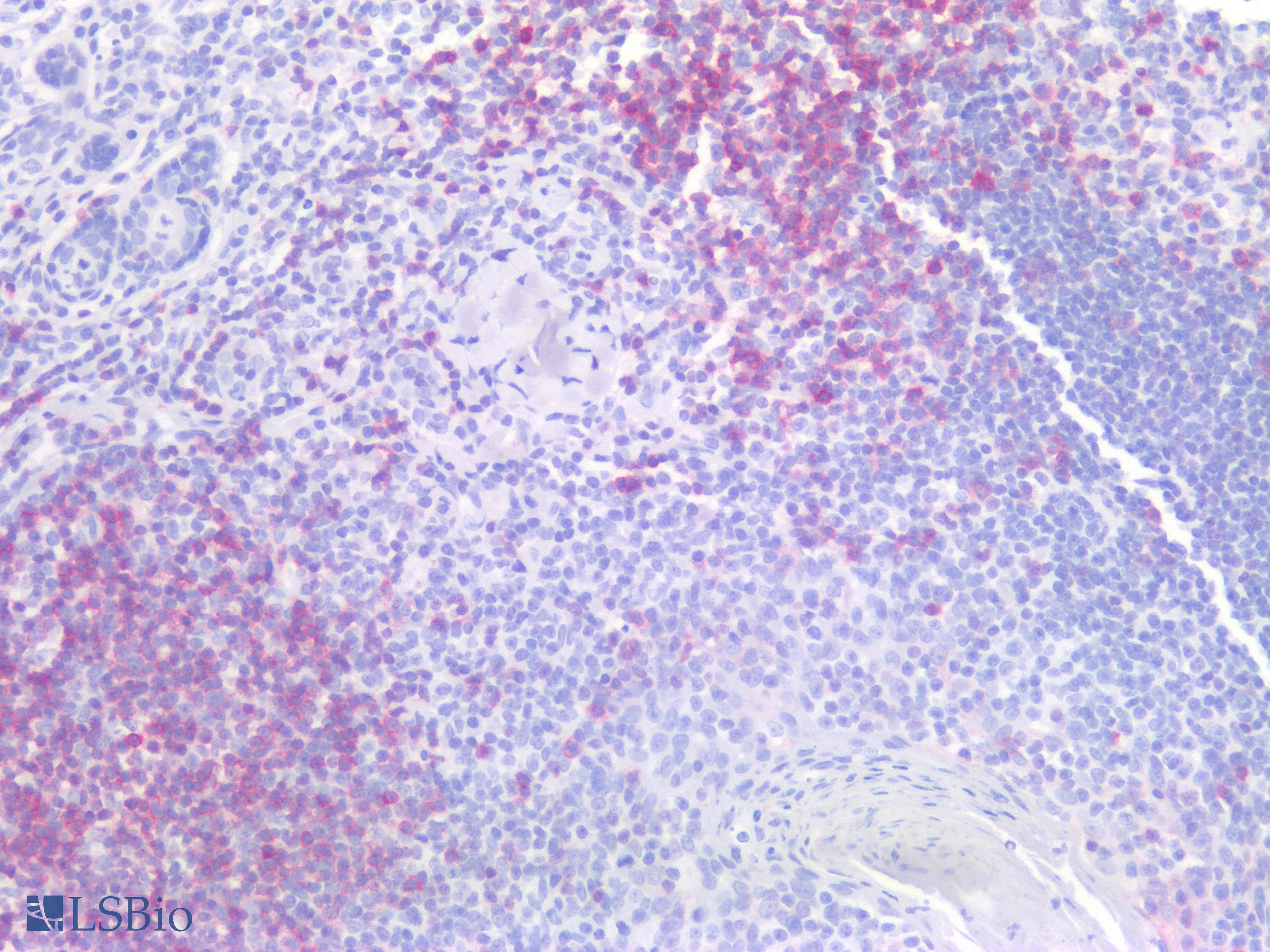 IHC-plus™ Monoclonal Mouse anti-Human CD5 Antibody (clone L17F12, IHC, WB)