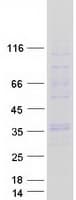 Human GJB4 / CX30.3 / Connexin 30.3 Protein (Recombinant Myc-DDK (Flag))
