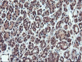 SERPINB1 Antibody (clone OTI4B3)