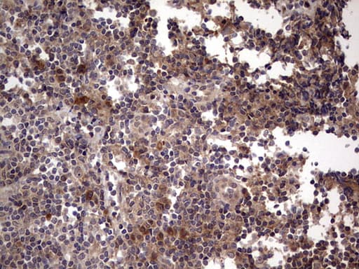 BFSP2 Antibody (aa184-415, clone OTI4E7, Carrier-free)