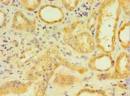 DCP2 Antibody (aa1-240)
