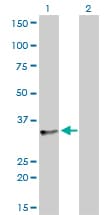 TRA2B / SFRS10 Antibody (clone 7A1)
