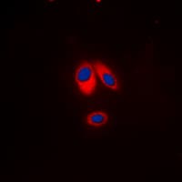NCF1 / p47phox / p47 phox Antibody (C-Terminus)