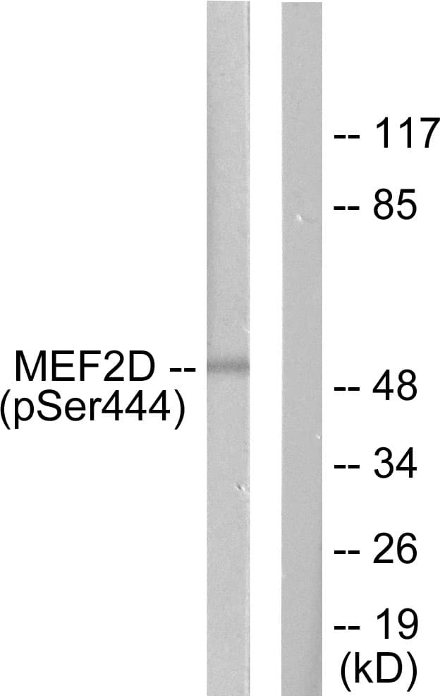 MEF2D Antibody (phospho-Ser444)