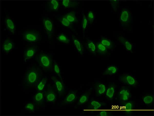 TAF11 Antibody (clone 3D3)