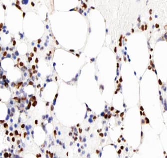 MMP8 Antibody