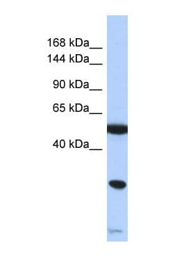 Polyclonal Rabbit anti-Human SMARCA2 / BRM Antibody (aa68-117, WB)