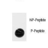Polyclonal Rabbit anti-Human TNK2 / ACK1 Antibody (phospho-Tyr518)