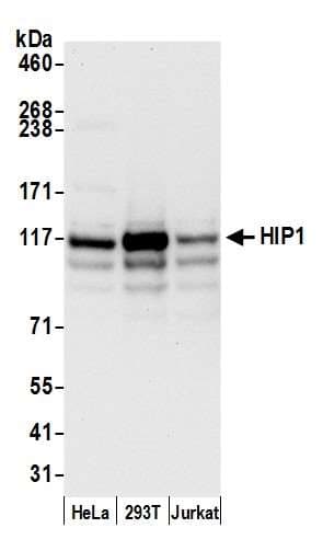 HIP1 Antibody (aa725-775)