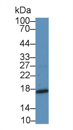 MDK / Midkine Antibody (aa22-140)