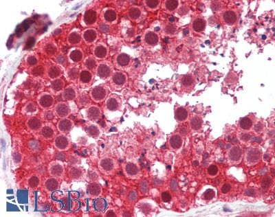 IHC-plus™ ORC6 / ORC6L Antibody