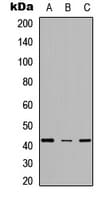 Polyclonal Rabbit anti-Human SCD1 / SCD Antibody (C-Terminus, WB)