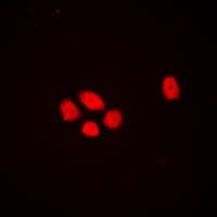 DLX3 Antibody (Internal)