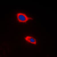 Polyclonal Rabbit anti-Human HCCS Antibody (Internal, IHC, IF, WB)