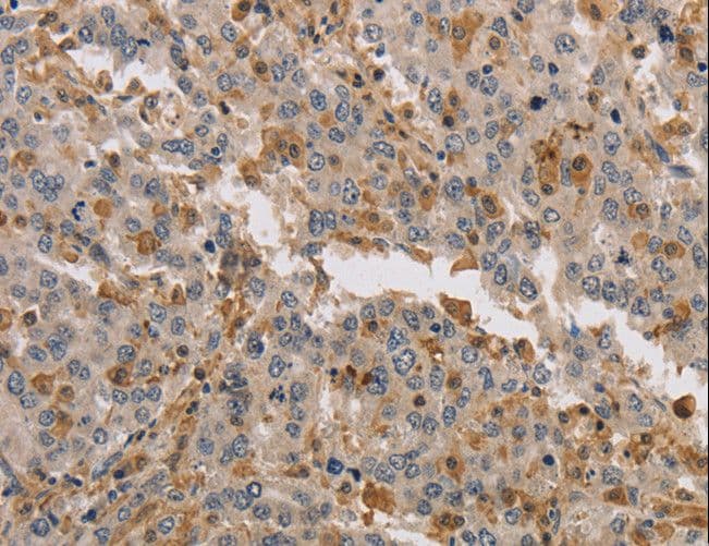 KIF17 Antibody