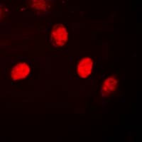 PR / Progesterone Receptor Antibody (Internal)