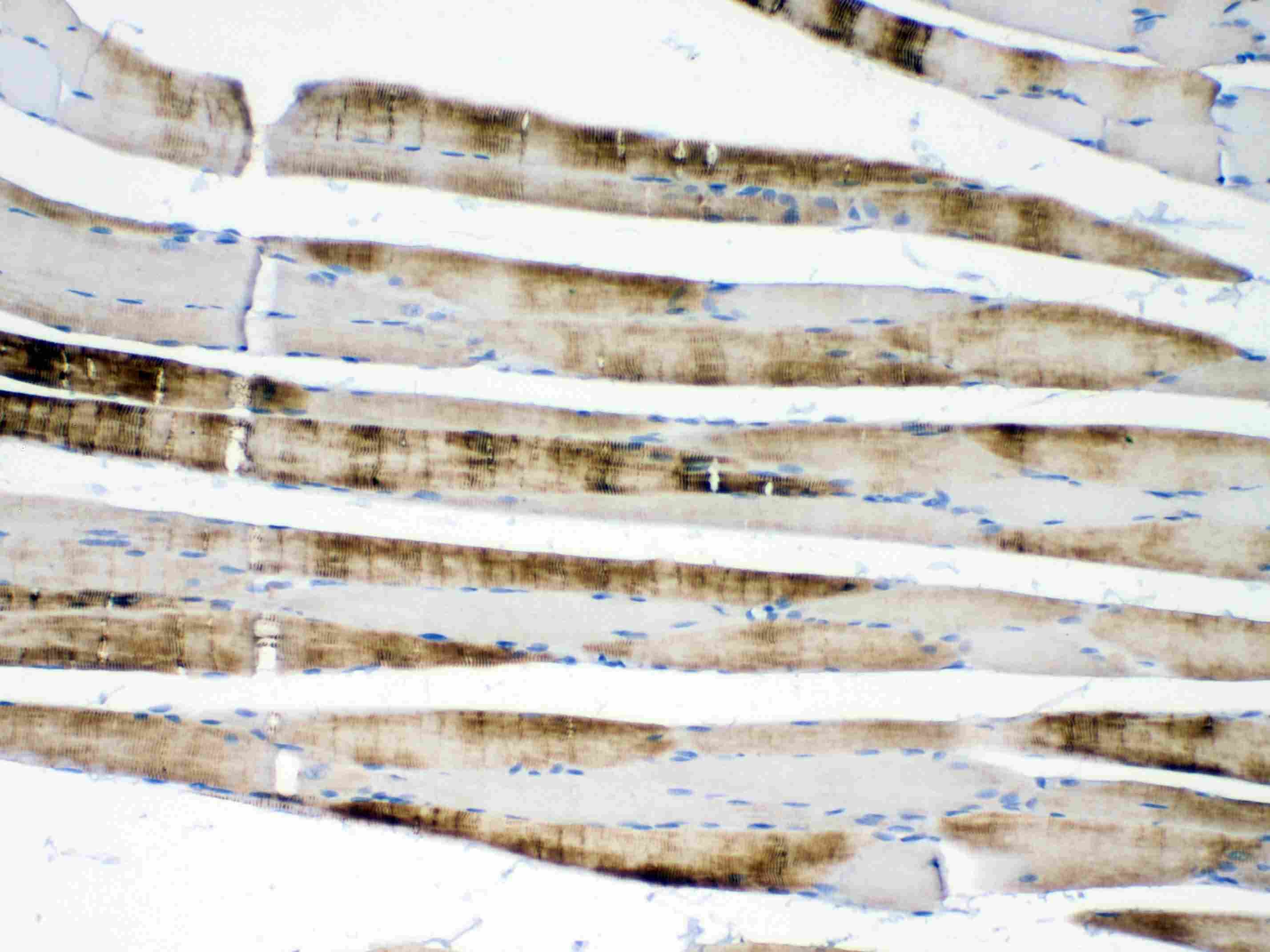 ACTN3 Antibody