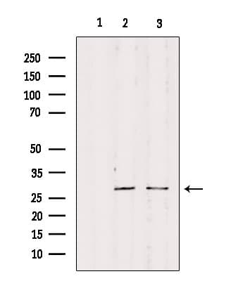 RPS4Y1 Antibody